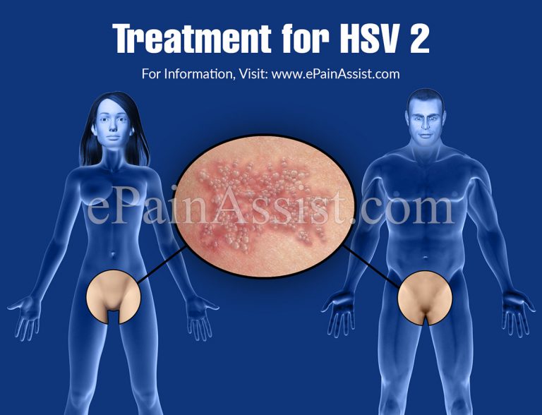 Treatment for HSV 2: Initial, Intermittent & Suppressive Treatment of HSV 2