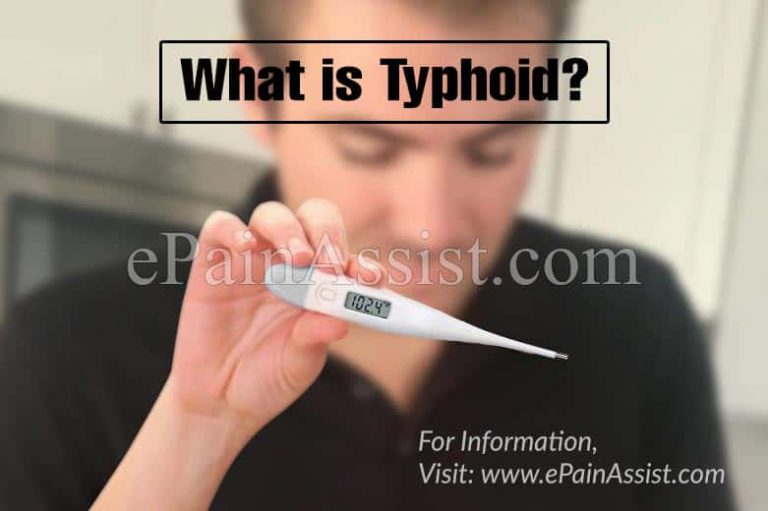 Typhoid: Causes, Symptoms, Treatments, Risk Factors, Prevention, Diagnosis