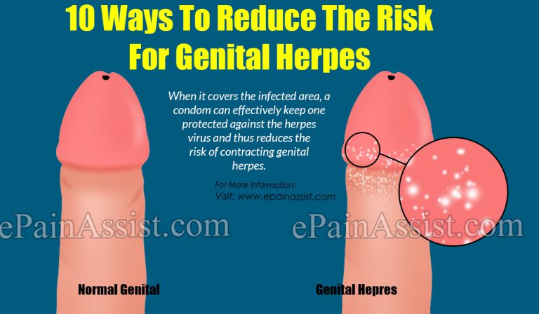 10 Ways To Reduce The Risk For Genital Herpes