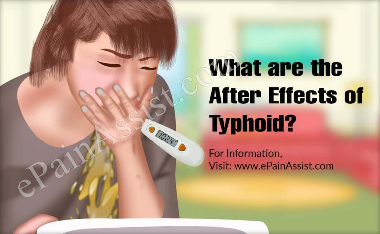 What are the After Effects of Typhoid?