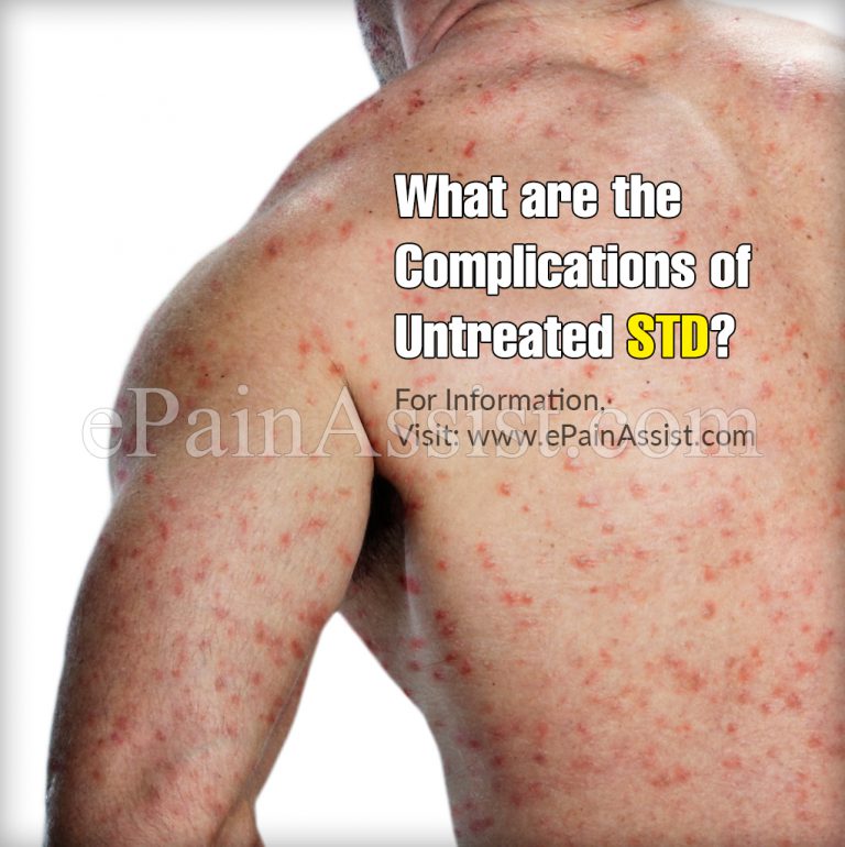 What are the Complications of Untreated STD?