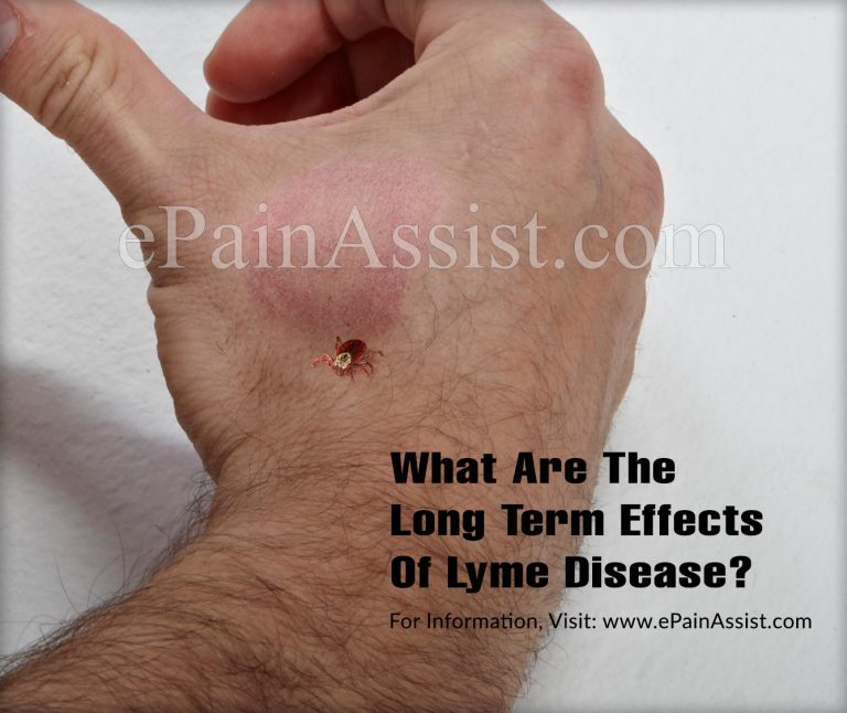 What Are The Long Term Effects Of Lyme Disease?
