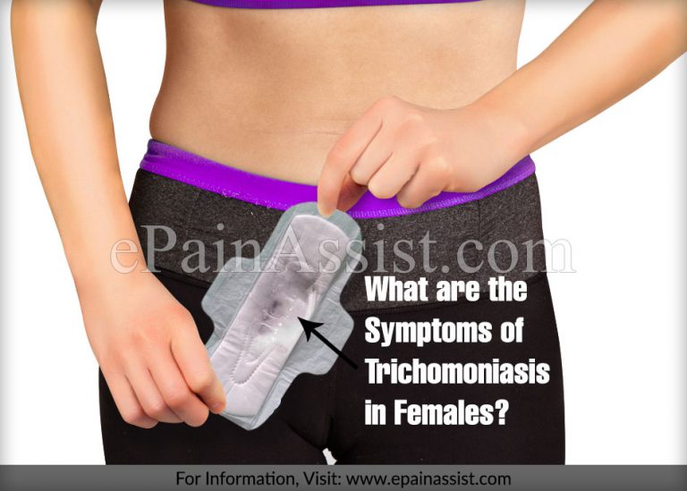 What are the Symptoms of Trichomoniasis in Females?