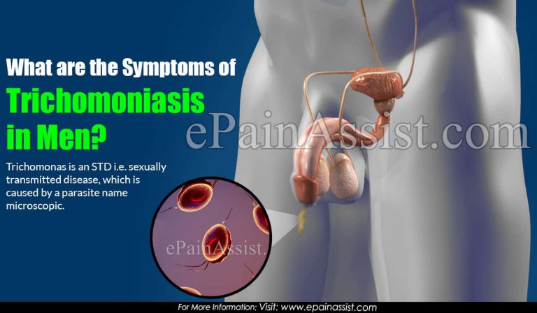 What are the Symptoms of Trichomoniasis in Men?