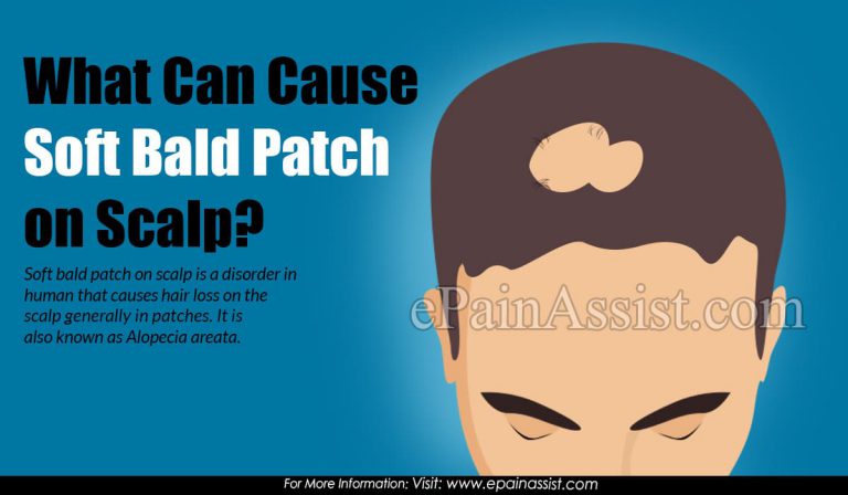 What Can Cause Soft Bald Patch on Scalp & Its Treatment