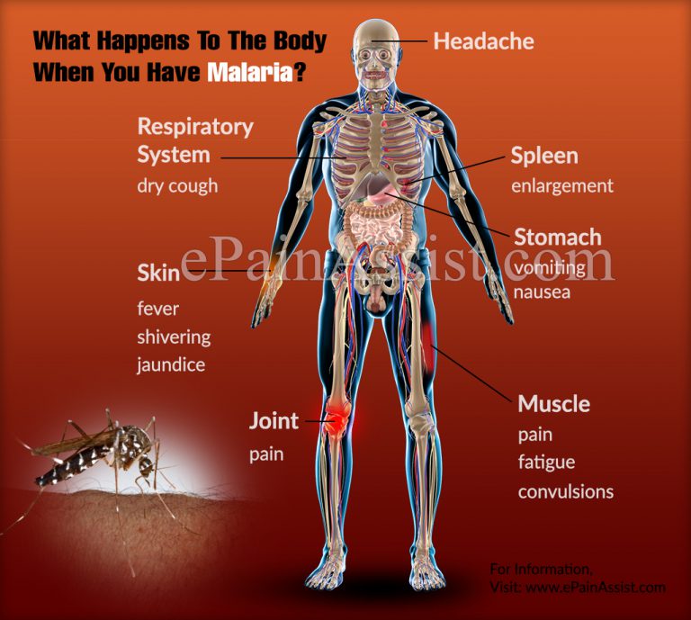 What Happens To The Body When You Have Malaria?