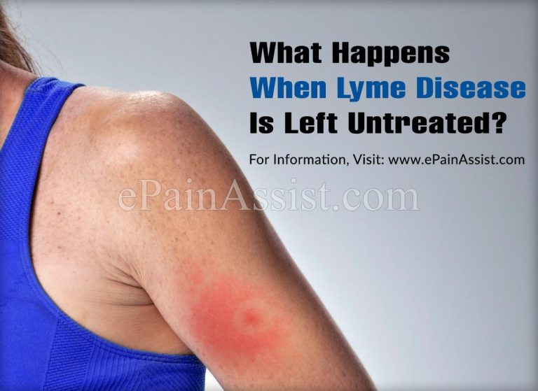 What Happens When Lyme Disease Is Left Untreated?