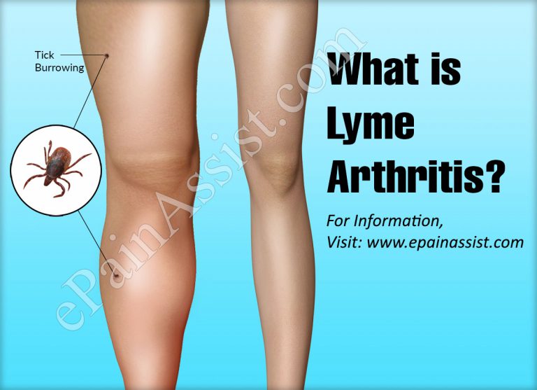 Occurrence of Lyme Arthritis & Its Treatment, Prevention