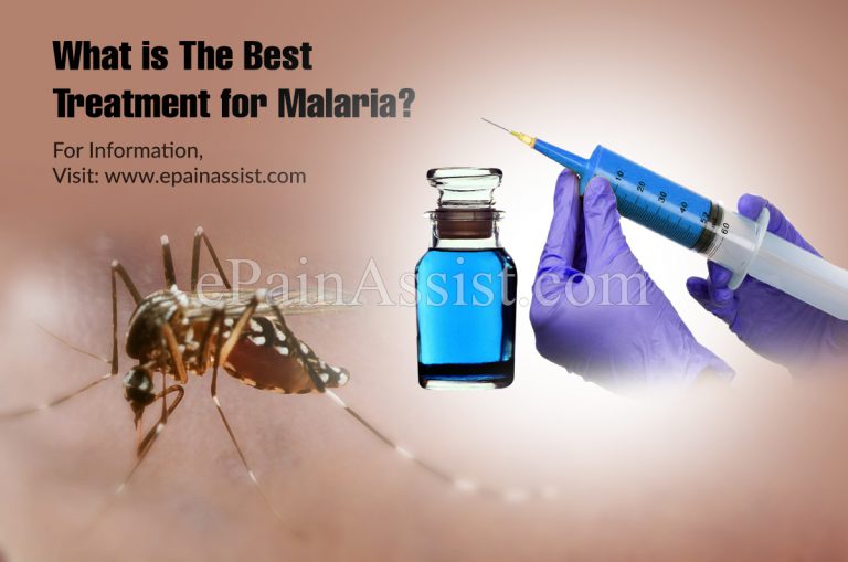 What is The Best Treatment for Malaria?