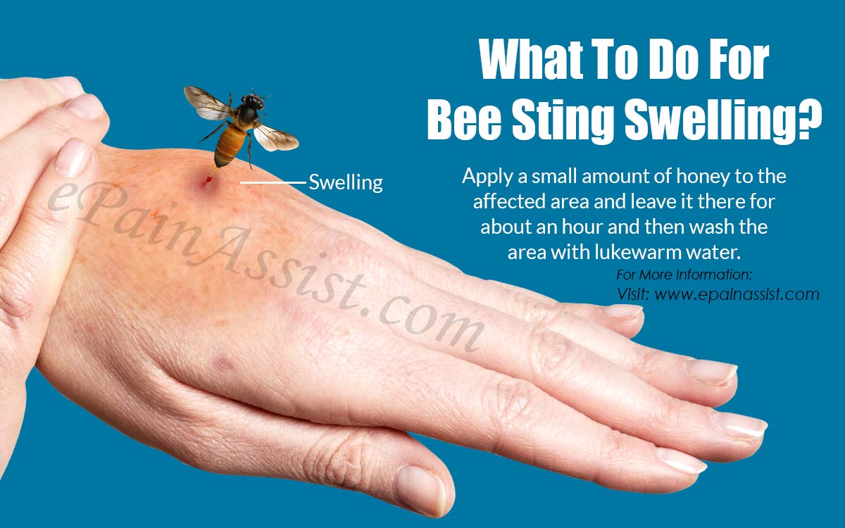 What To Do For Bee Sting Swelling?