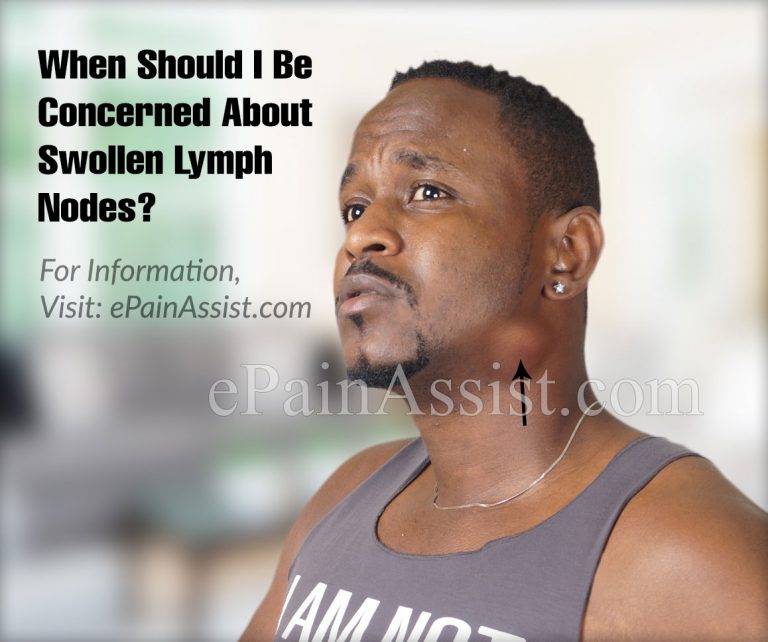 When Should I Be Concerned About Swollen Lymph Nodes?