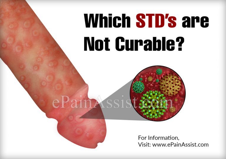 Which STDs are Not Curable?