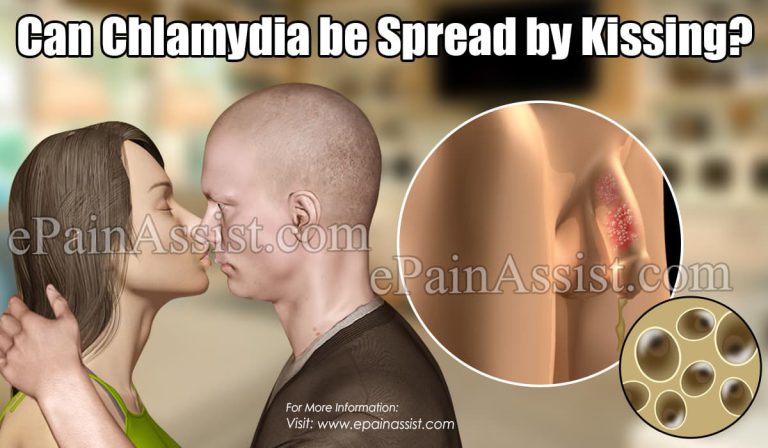 Can Chlamydia be Spread by Kissing?