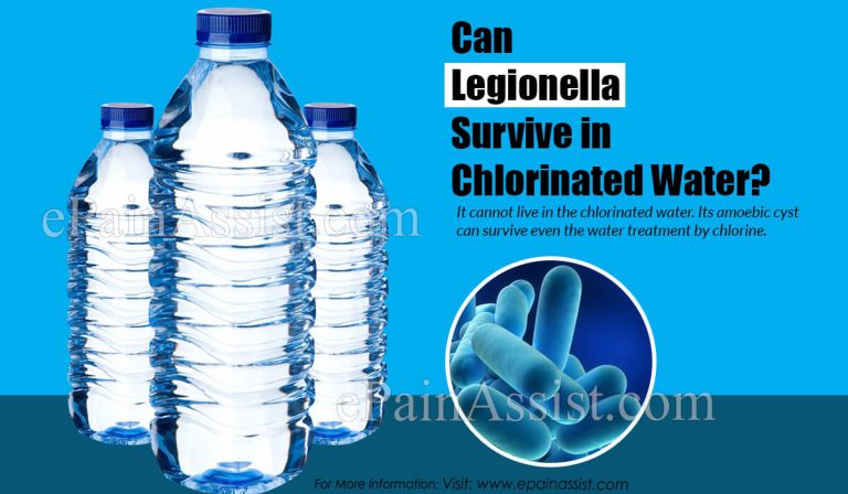 Can Legionella Survive in Chlorinated Water?