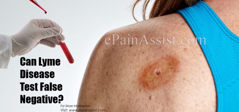 Can Lyme Disease Test False Negative?