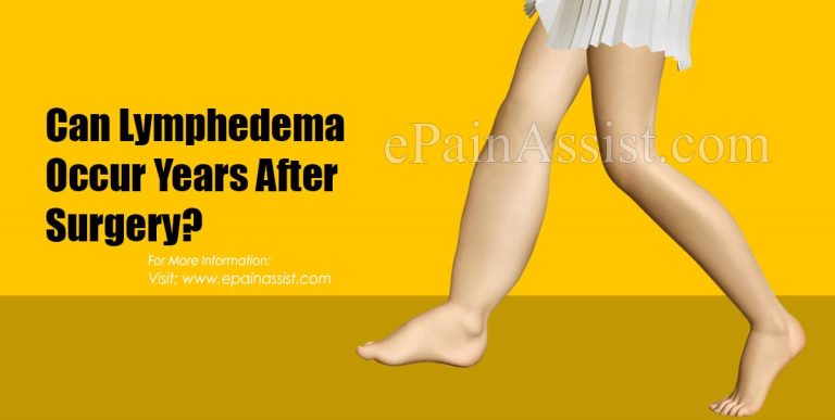 Can Lymphedema Occur Years After Surgery?