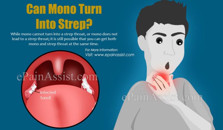 Can Mono Turn Into Strep?