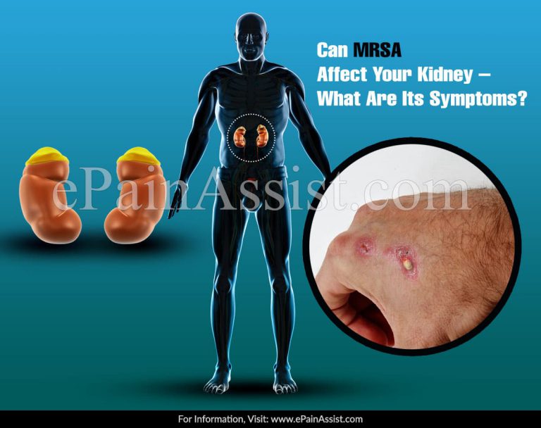Can MRSA Affect Your Kidney – What Are Its Symptoms?