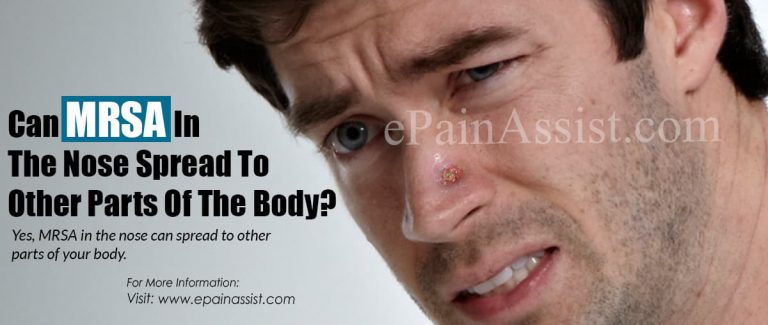 Can MRSA In The Nose Spread To Other Parts Of The Body?