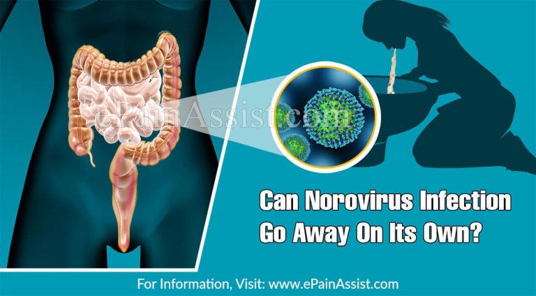 Can Norovirus Infection Go Away On Its Own & What Are It’s Natural Remedies?