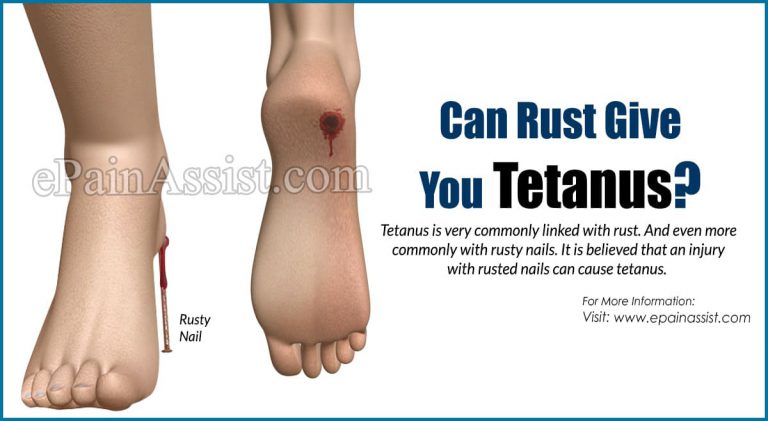 Can Rust Give You Tetanus?
