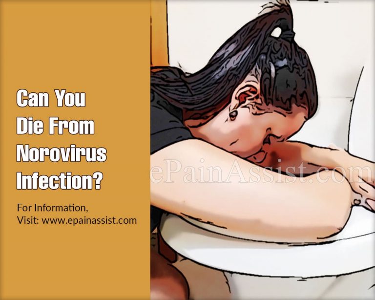 Can You Die From Norovirus Infection & Are There Any Complications?