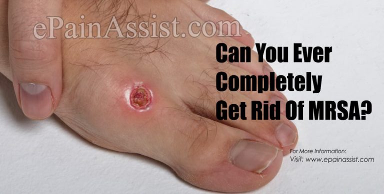 Can You Ever Completely Get Rid Of MRSA?