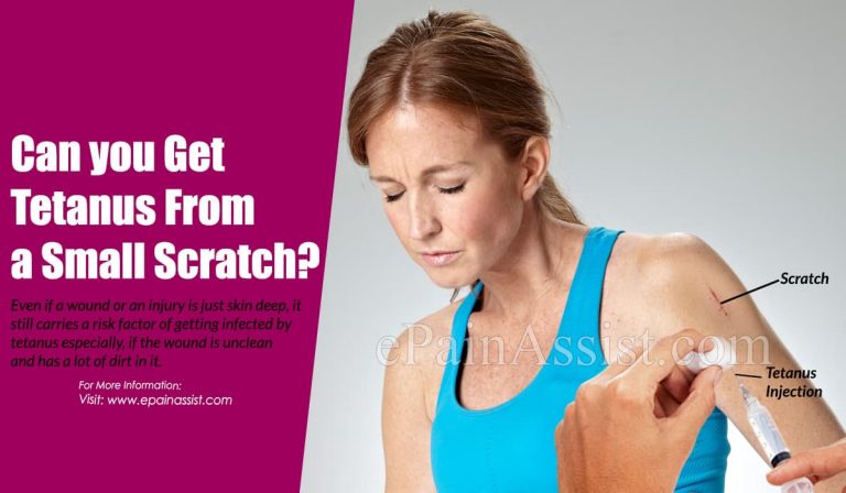 Can You Get Tetanus From A Small Scratch?
