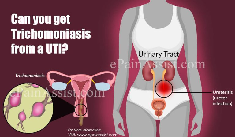 Can you get Trichomoniasis from a UTI?