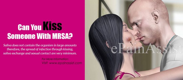 Can You Kiss Someone With MRSA?