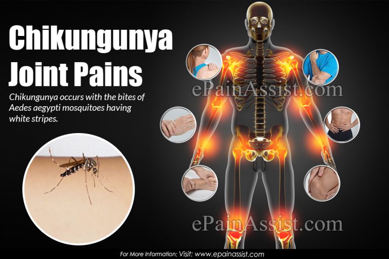 Chikungunya Joint Pains: How To Get Rid of it & How Long It Takes To Recover From Chikungunya Joint Pain?