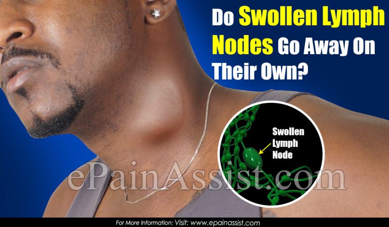 Do Swollen Lymph Nodes Go Away On Their Own?