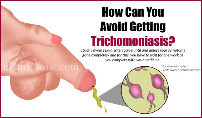 How Can You Avoid Getting Trichomoniasis?