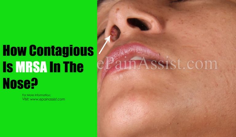 How Contagious Is MRSA In The Nose?