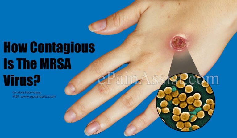 How Contagious Is The MRSA Virus?