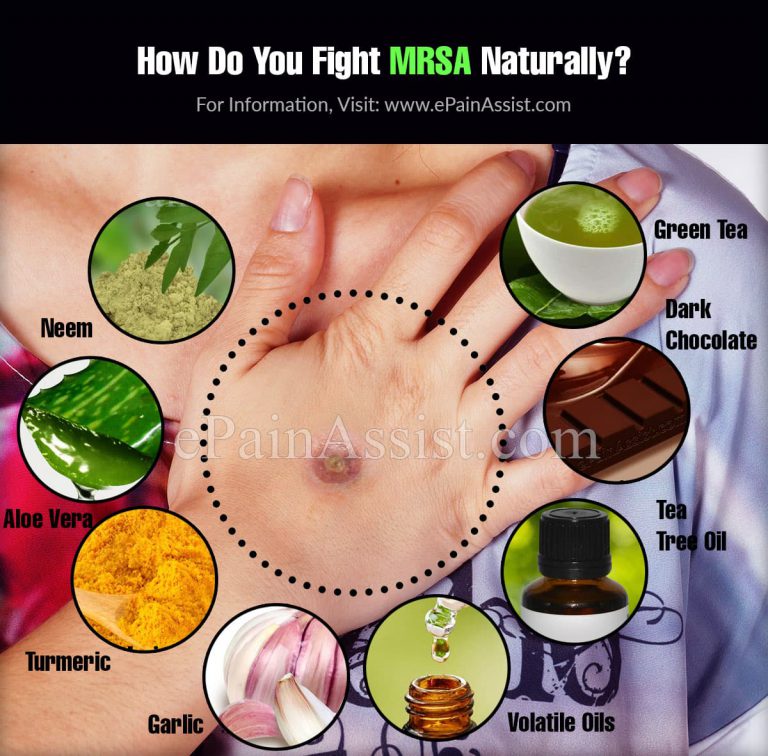 How Do You Fight MRSA Naturally?