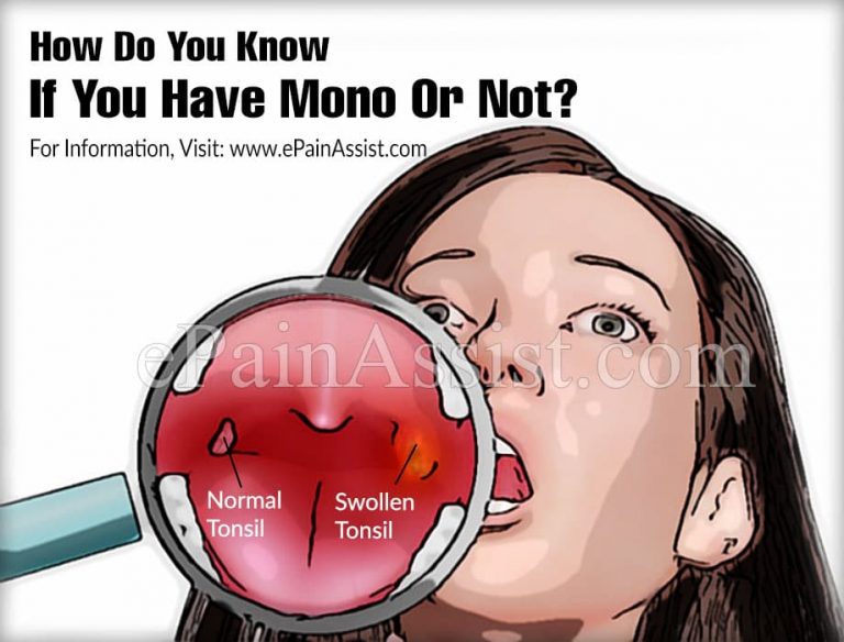 How Do You Know If You Have Mono Or Not?