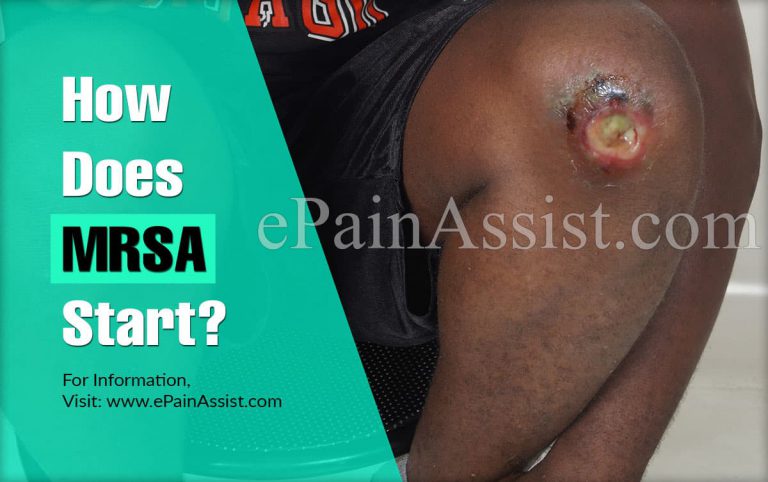 How Does MRSA Start & What Are Its Complications?