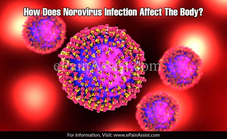 How Does Norovirus Infection Affect The Body & What Triggers It?