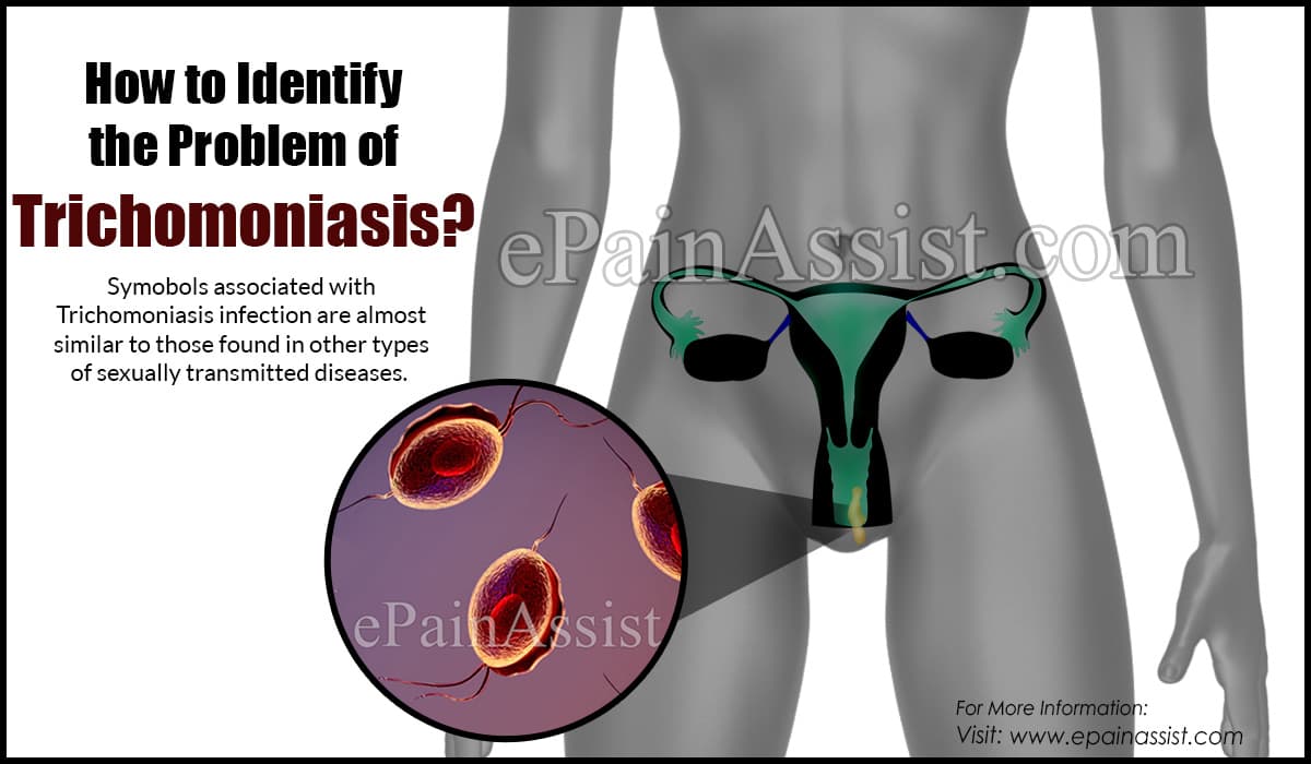 How to Identify the Problem of Trichomoniasis