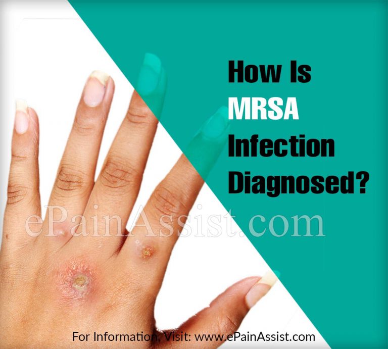 How Is MRSA Infection Diagnosed?