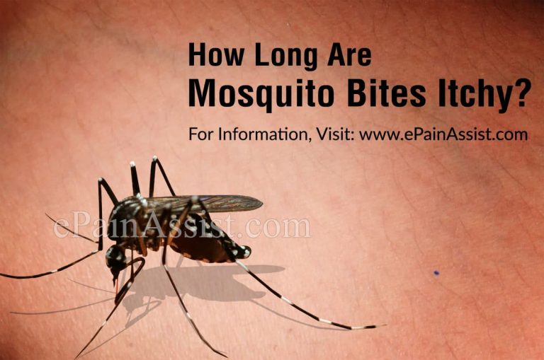 How Long Are Mosquito Bites Itchy?