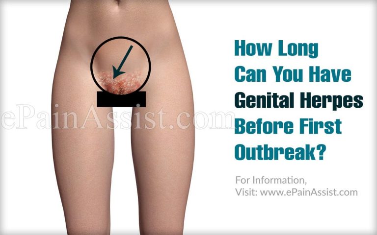 How Long Can You Have Genital Herpes Before First Outbreak?