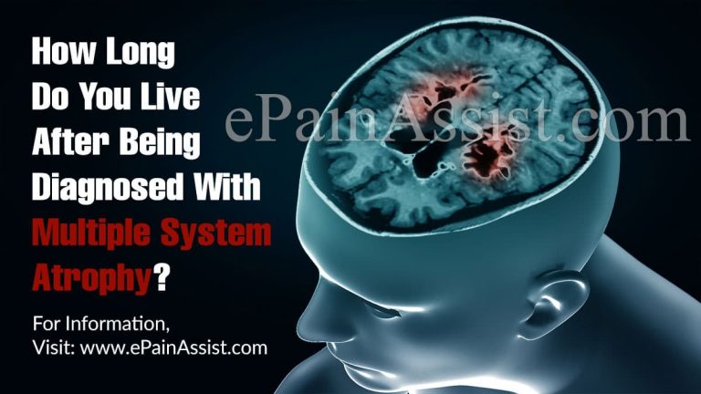 How Long Do You Live After Being Diagnosed With Multiple System Atrophy?