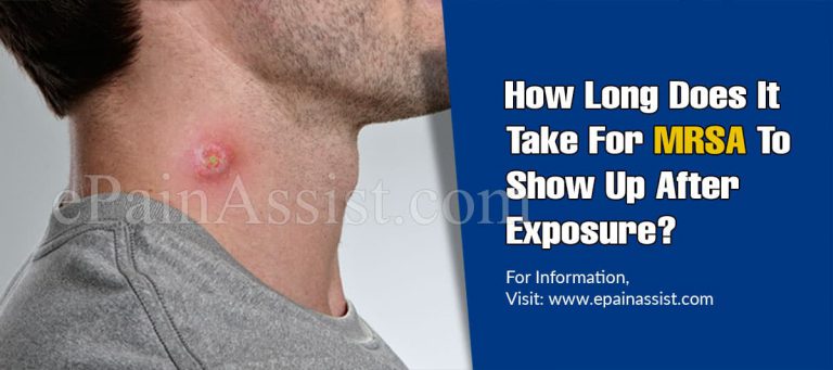 How Long Does It Take For MRSA To Show Up After Exposure?