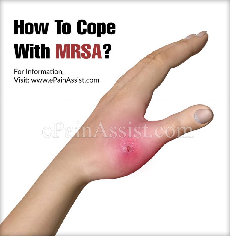How To Cope With MRSA?