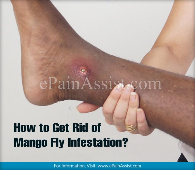 How to Get Rid of Mango Fly Infestation?|Signs, Symptoms And Prevention of Mango Fly Infestation