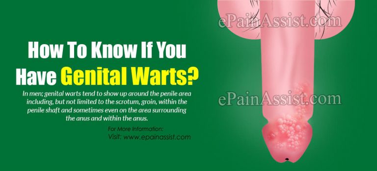 How To Know If You Have Genital Warts?