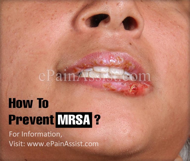How To Prevent MRSA?