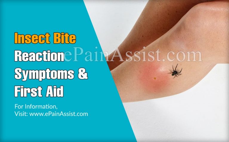 Insect Bite Reaction Symptoms and First Aid